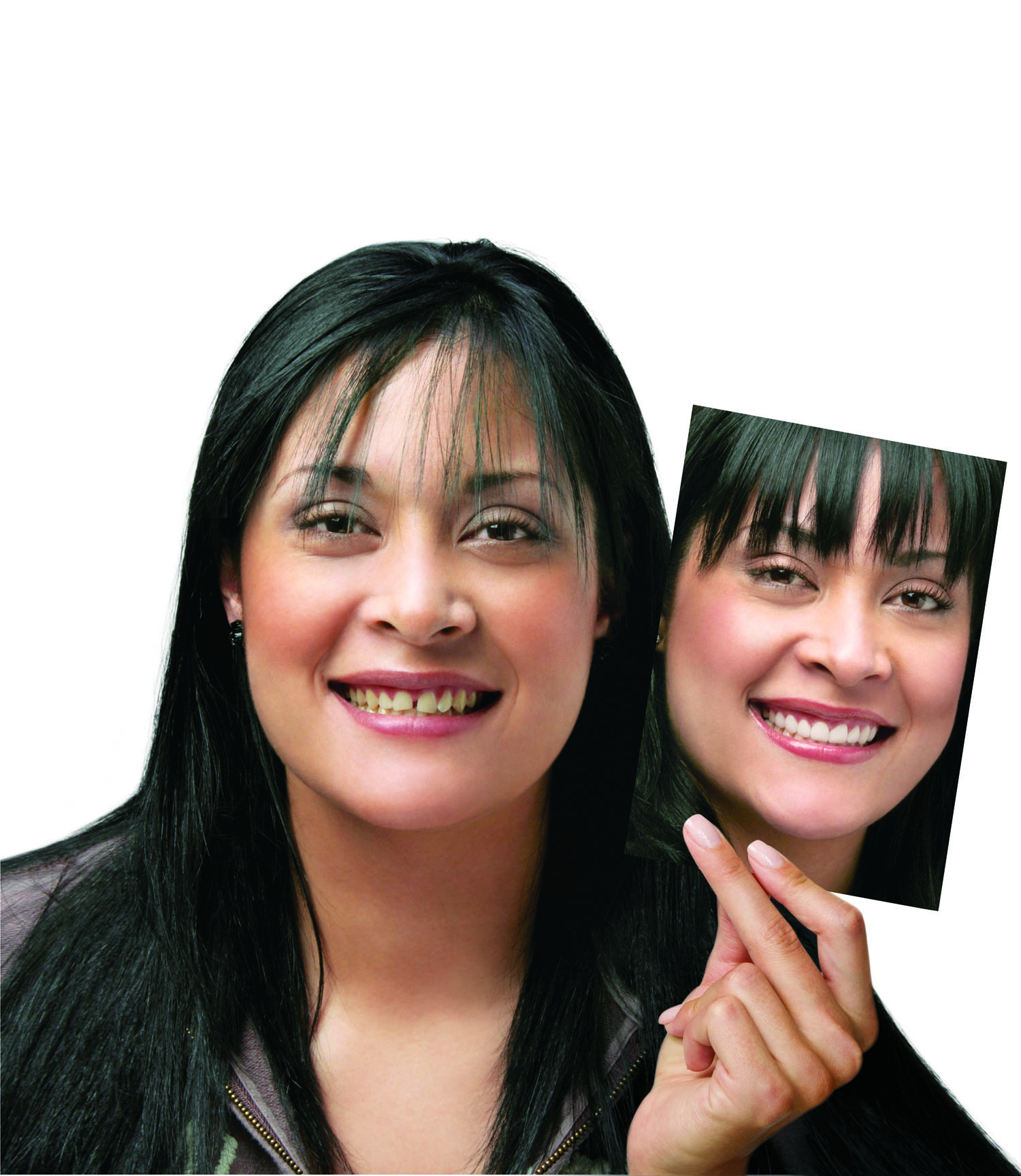 smile-makeover-hinsdale