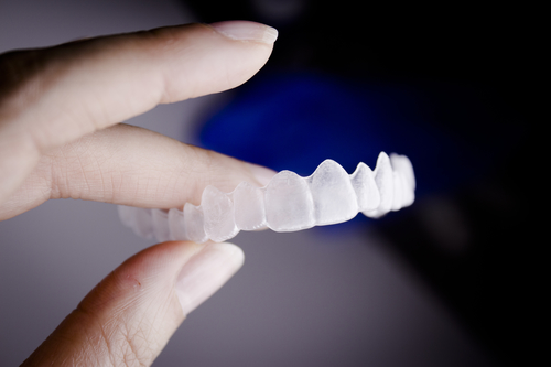 Woman hand holding top invisible dental braces