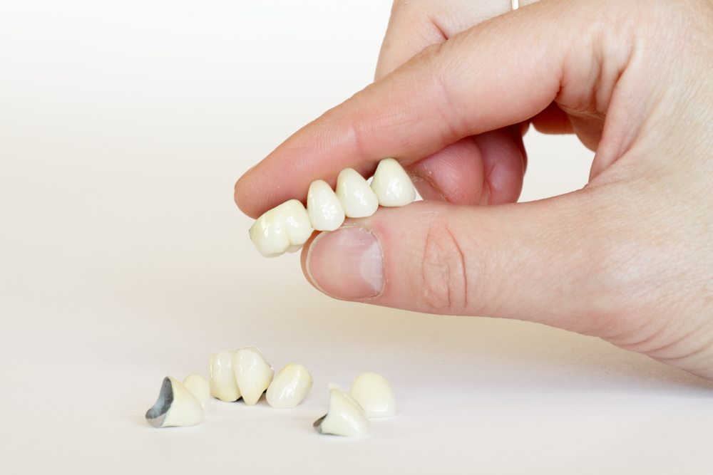 holding dental crowns in hand