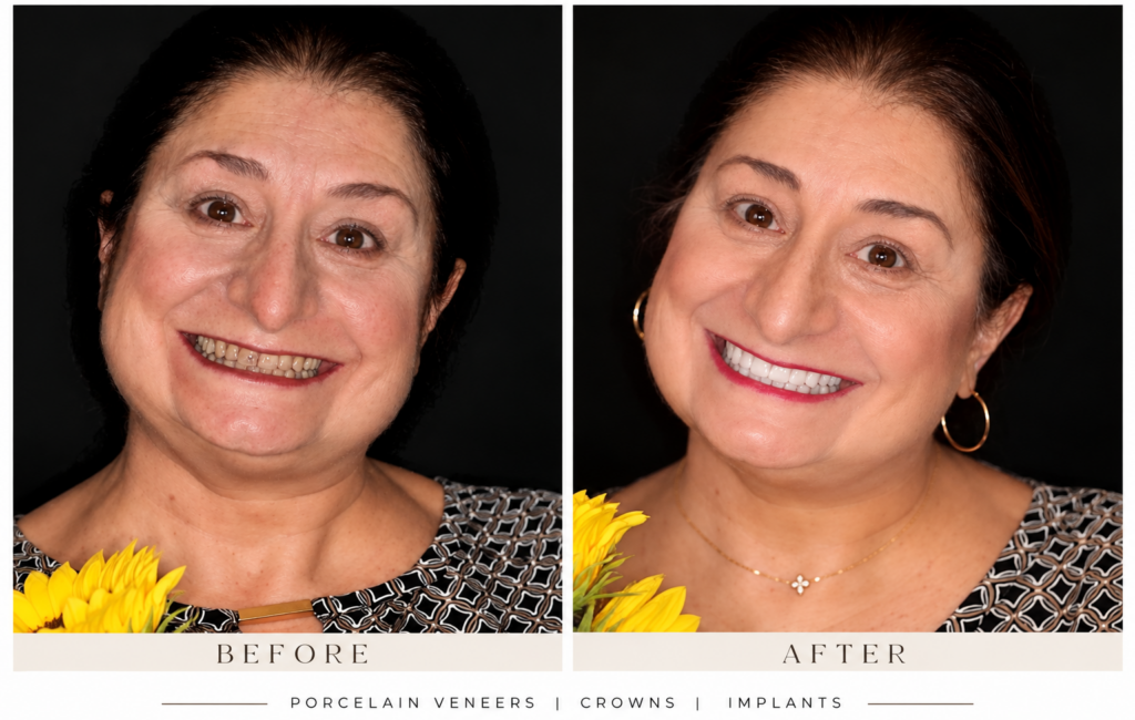 before and after cosmetic dentistry dr moran
